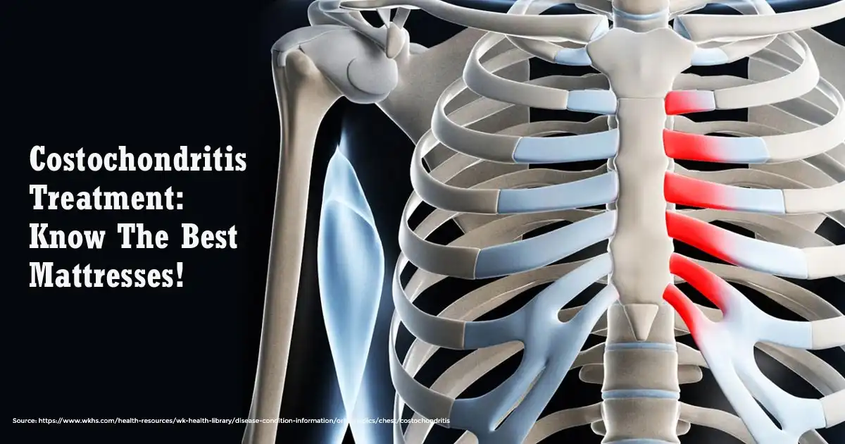 Costochondritis Treatment: Know the Best Mattresses!