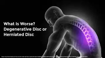 What Is Worse? Degenerative Disc or Herniated Disc